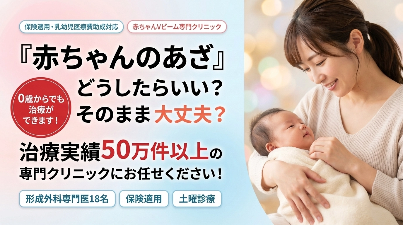 赤ちゃんの赤あざ 0歳から保険で治療できます Vビームレーザー治療